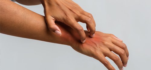 The Lowdown on Psoriasis: Signs, Symptoms, and Treatments